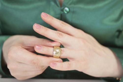 Come ottenere un anello al largo di un dito gonfio