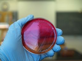 Tipi di colonie di batteri