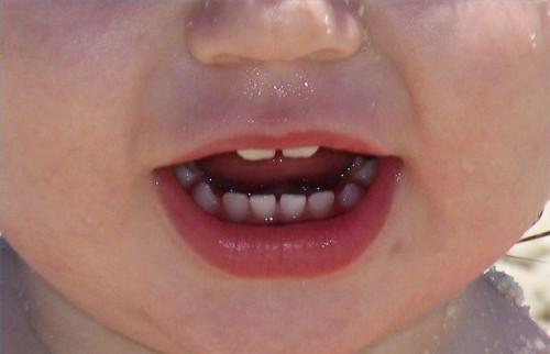 Crescita di denti del bambino